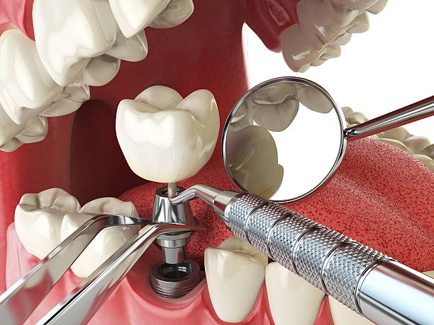 Best Emergency Dental Care for Broken or Chipped Teeth in Rio, WI
